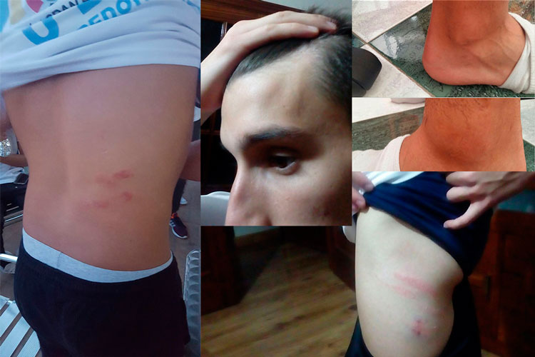 Los juveniles del Torredonjimeno sufren agresiones en Almería